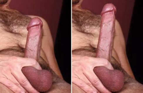 before and after having increased the member of the soda