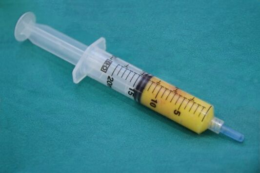 Adipose tissue syringe for lipofilling