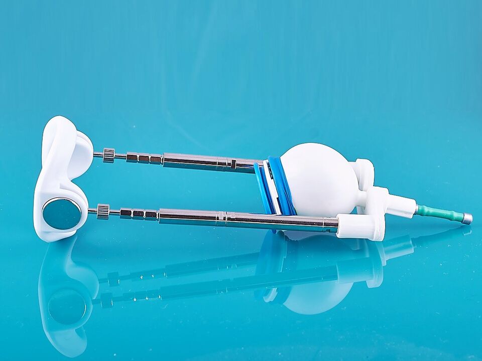 The expander will help improve the result of ligamentotomy