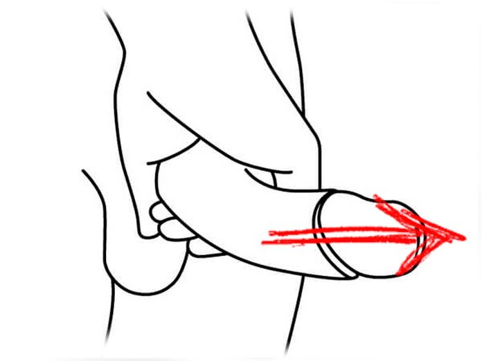 stretch the penis to enlarge it